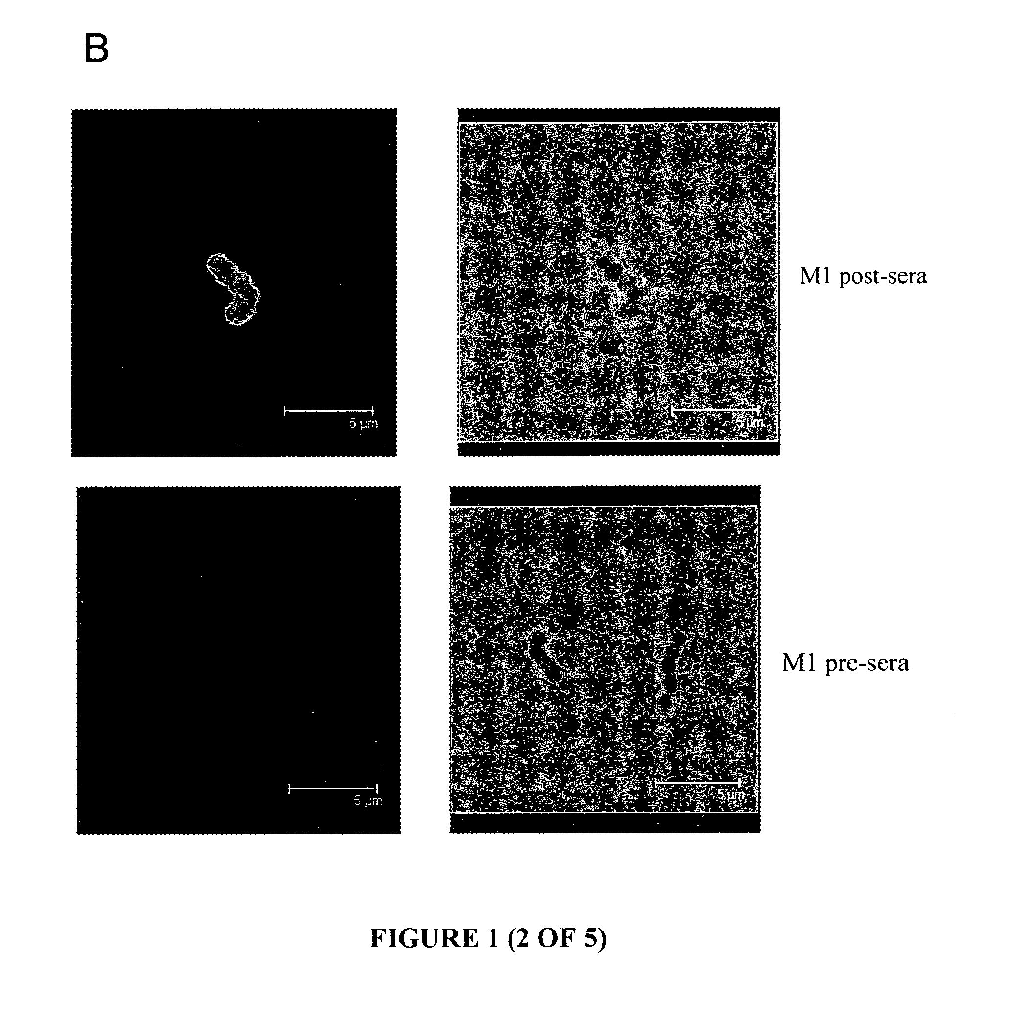 Group A Streptococcus Pharmaceutical Compositions and Methods Thereof