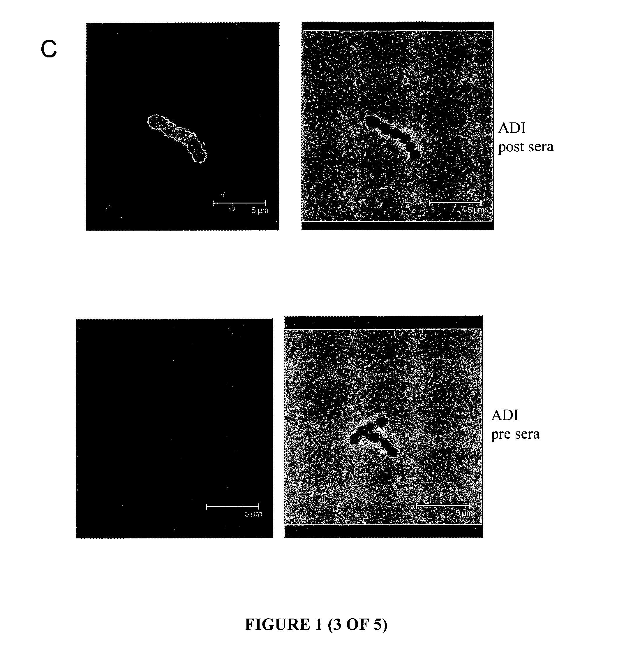 Group A Streptococcus Pharmaceutical Compositions and Methods Thereof