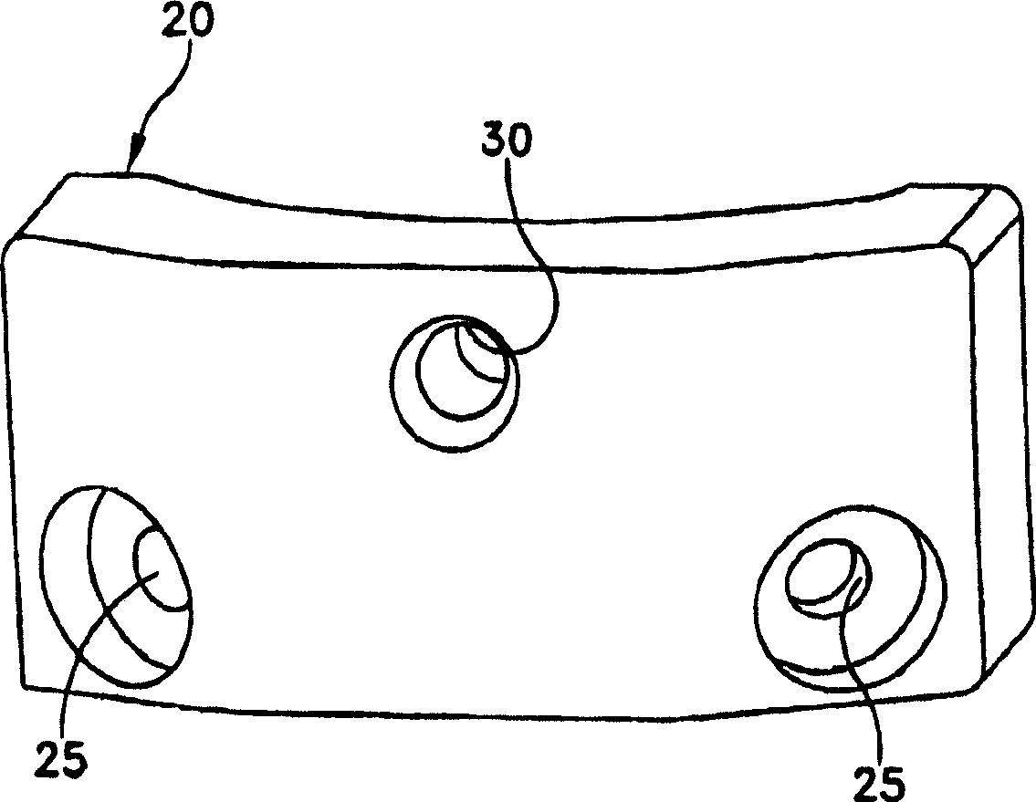 Open wedge osteotomy system and surgical method