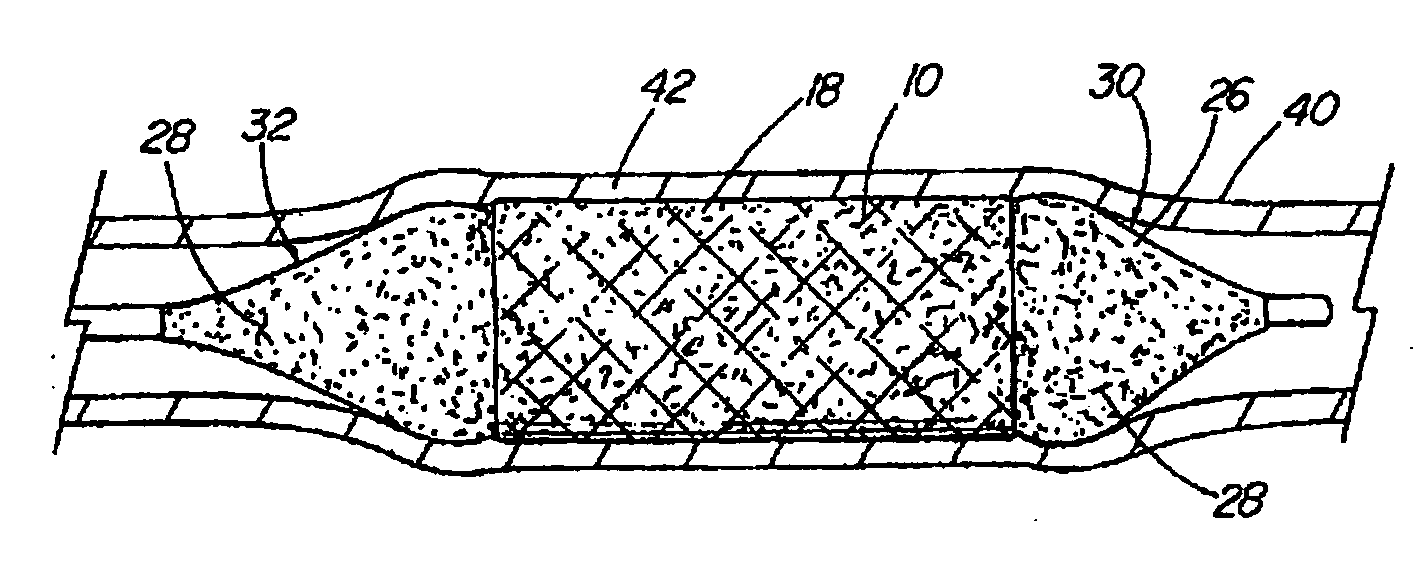Coated medical device