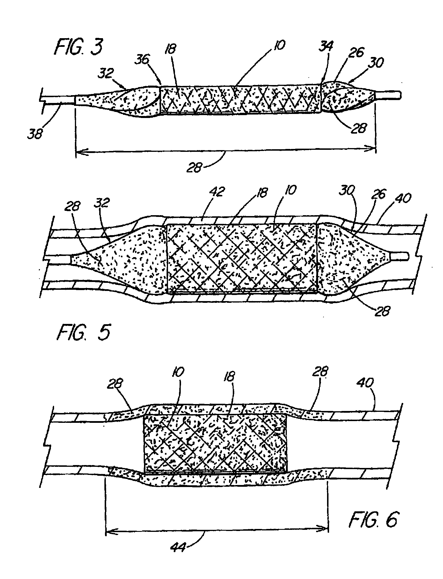 Coated medical device