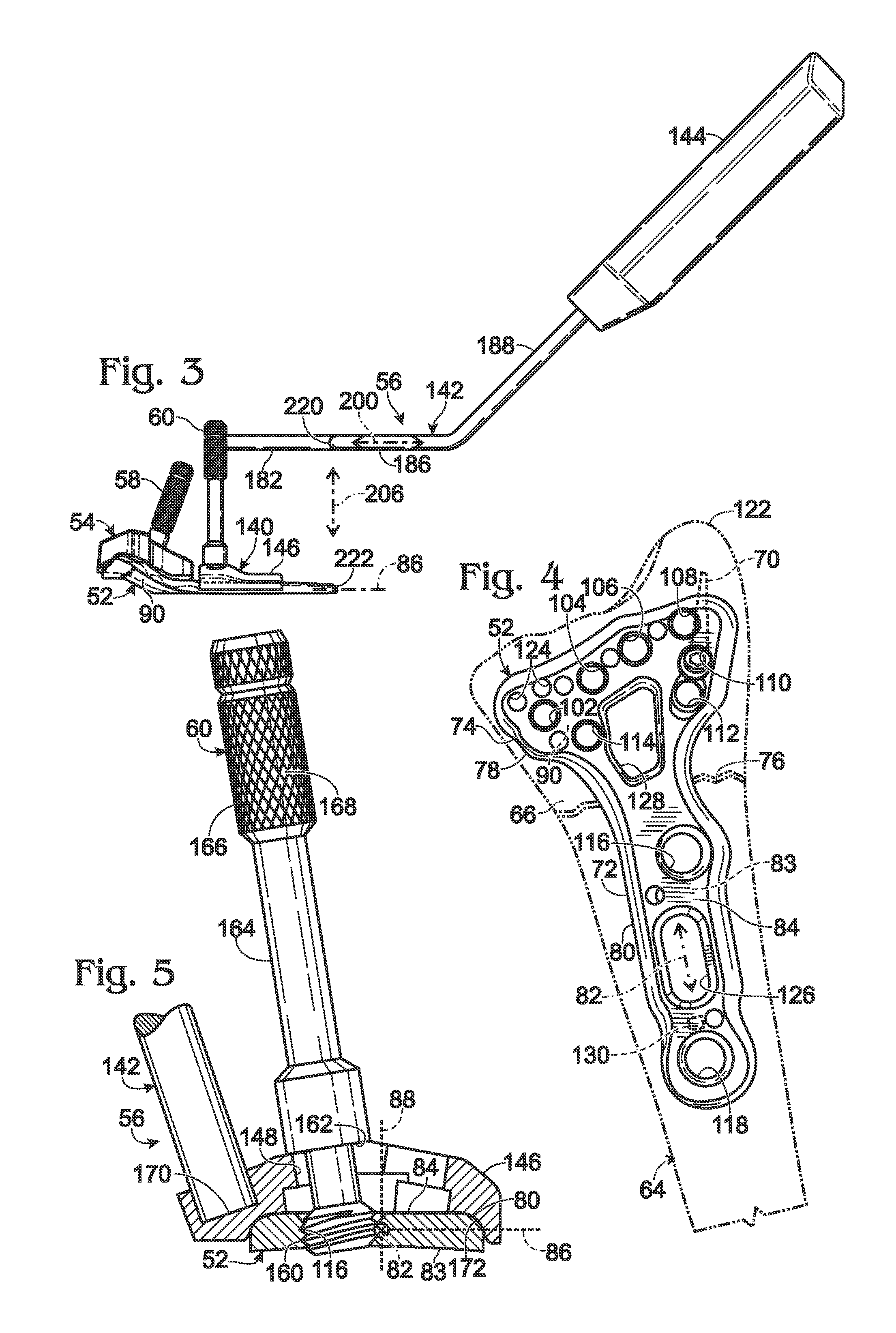 Handle assembly having a radiopaque region to facilitate positioning a bone plate on bone