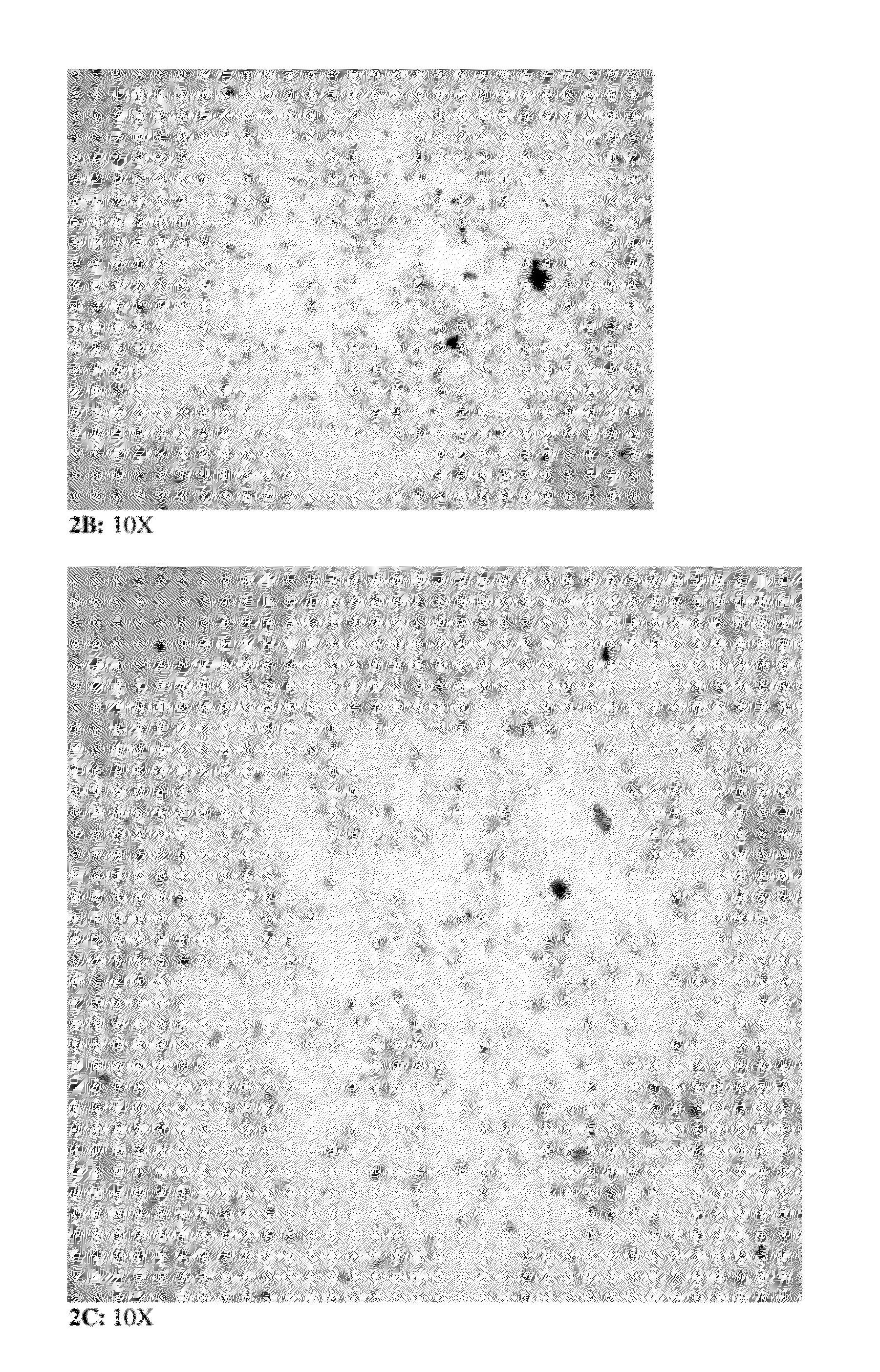 Device and Methods for the Detection of Cervical Disease