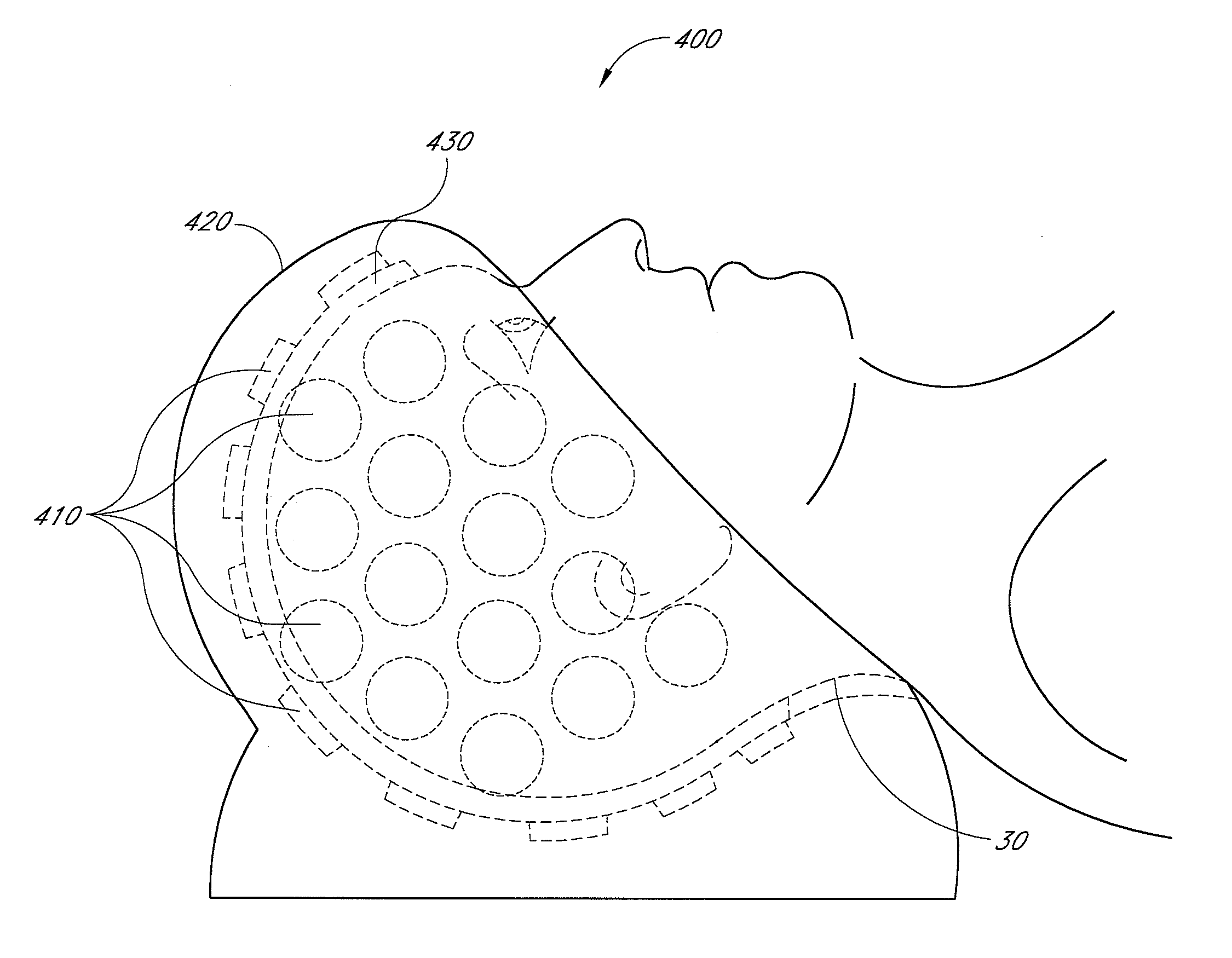 Light-emitting device and method for providing phototherapy to the brain