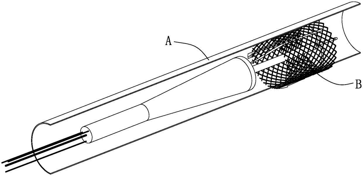 Medical device handle operation end and interventional treatment system