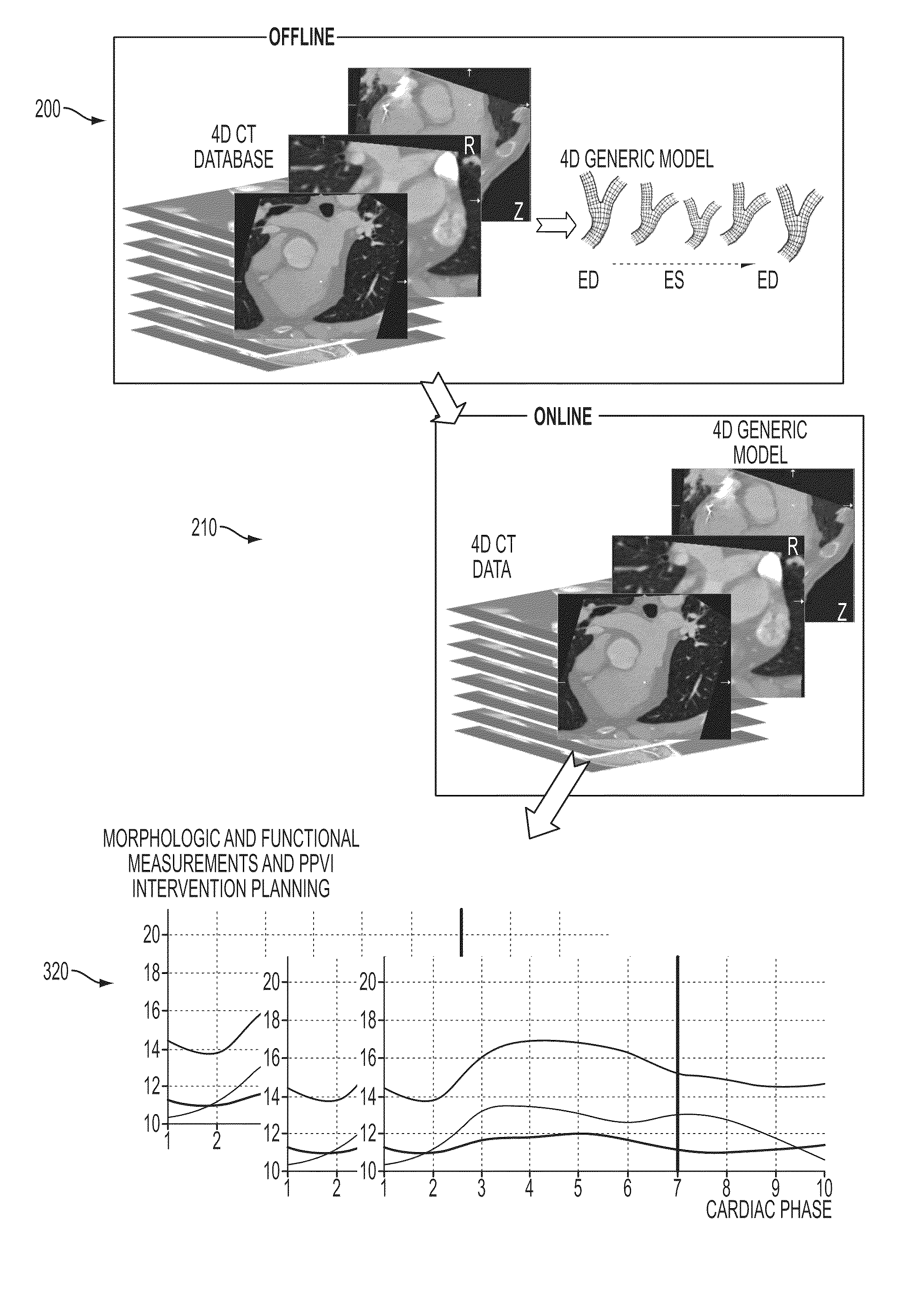 Method and system for dynamic pulmonary trunk modeling and intervention planning