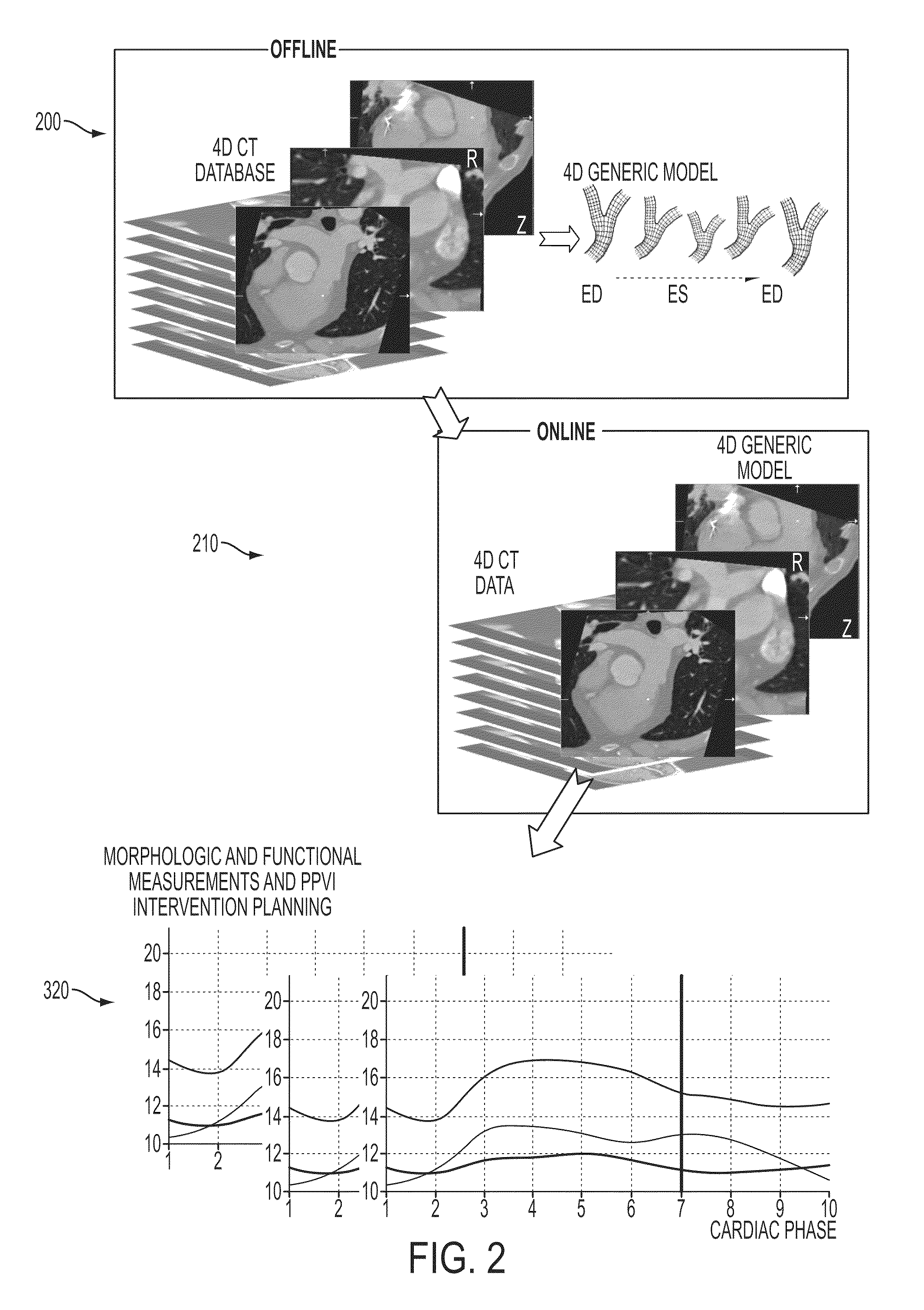 Method and system for dynamic pulmonary trunk modeling and intervention planning