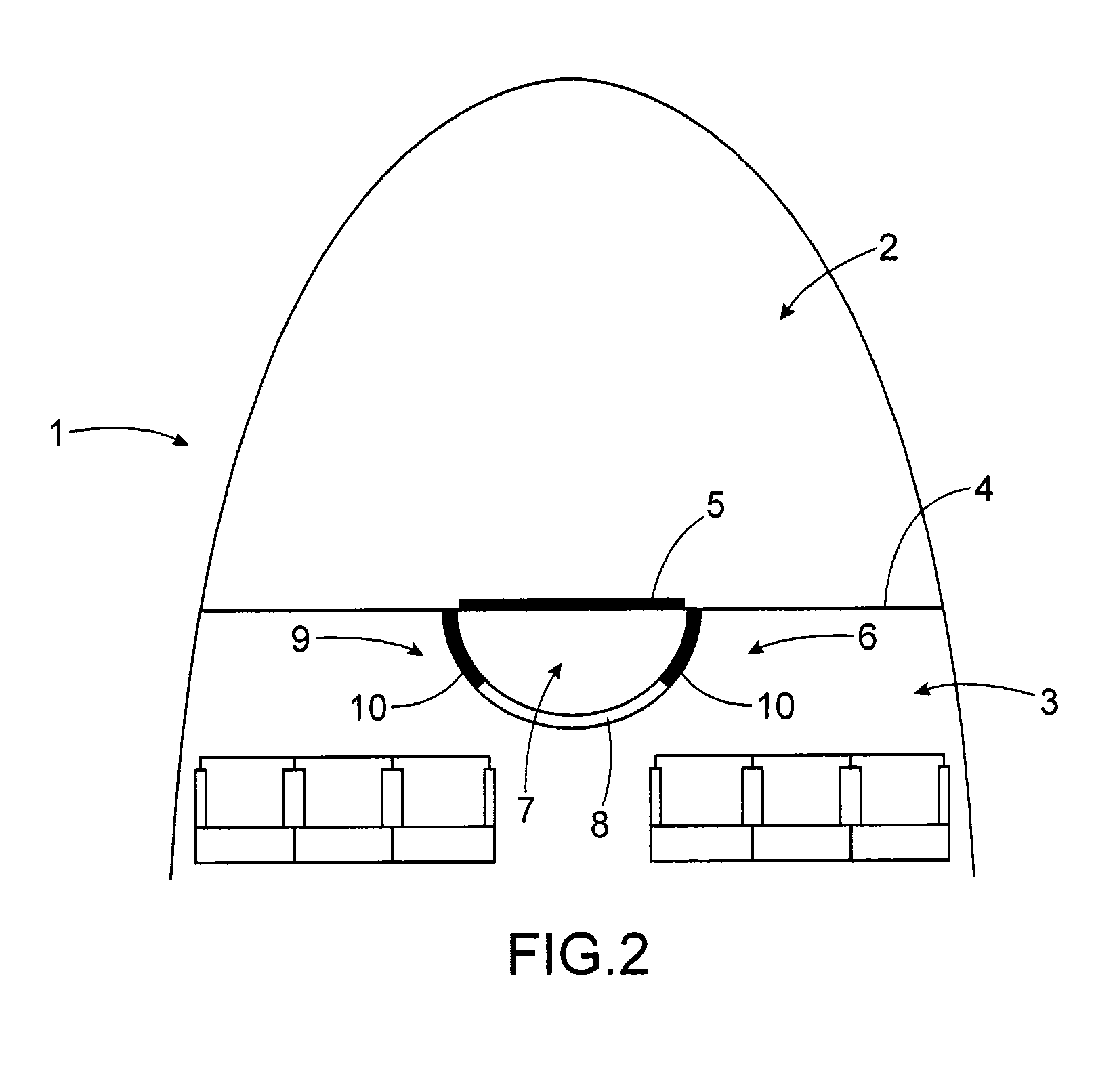 Aircraft nose section including a lock for accessing the cockpit