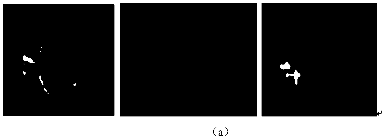 Three-dimensional U-Net brain tumor segmentation method fusing conditional randomness and residual errors