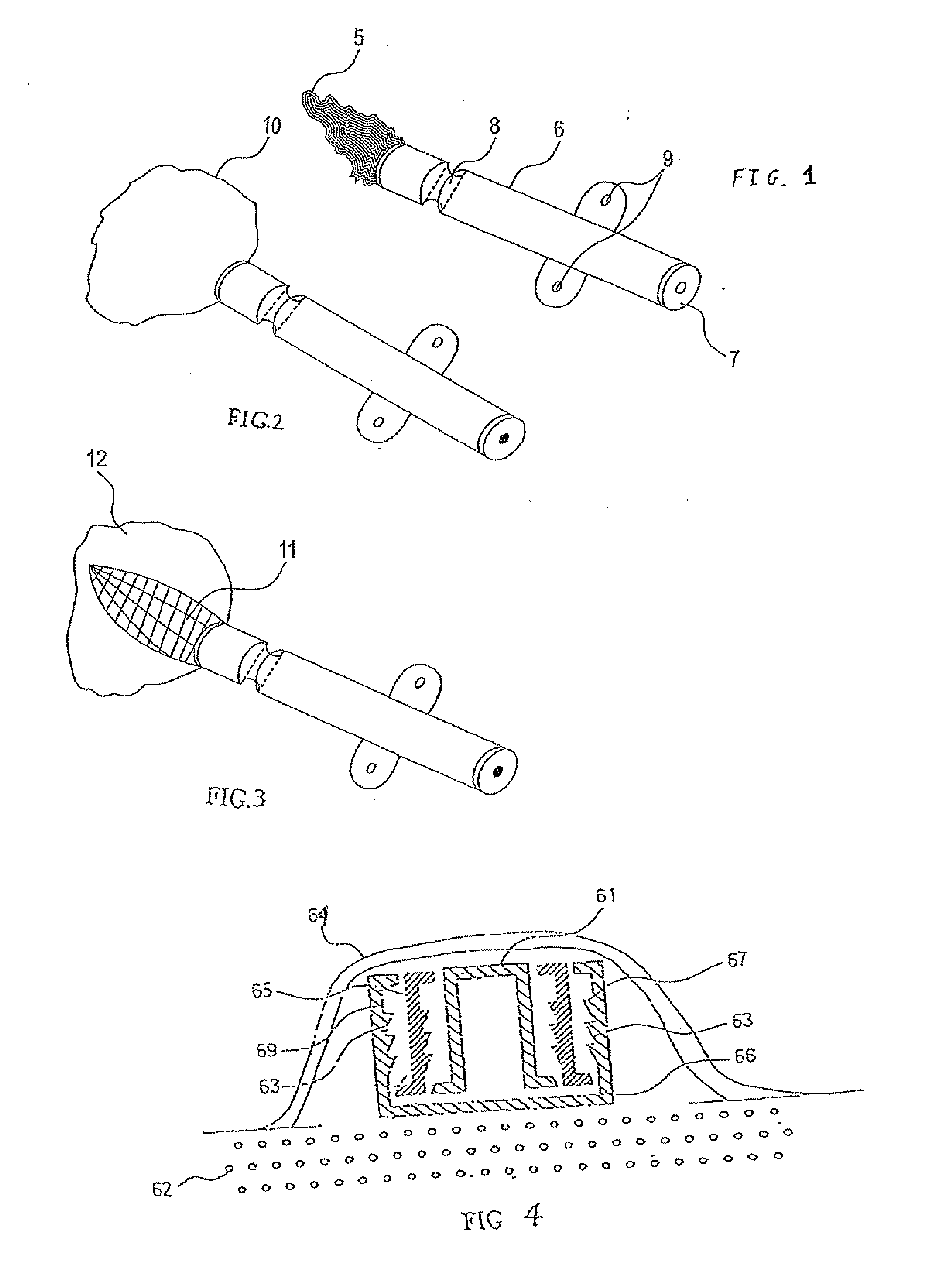 Expandable devices and methods for tissue expansion, regeneration and fixation