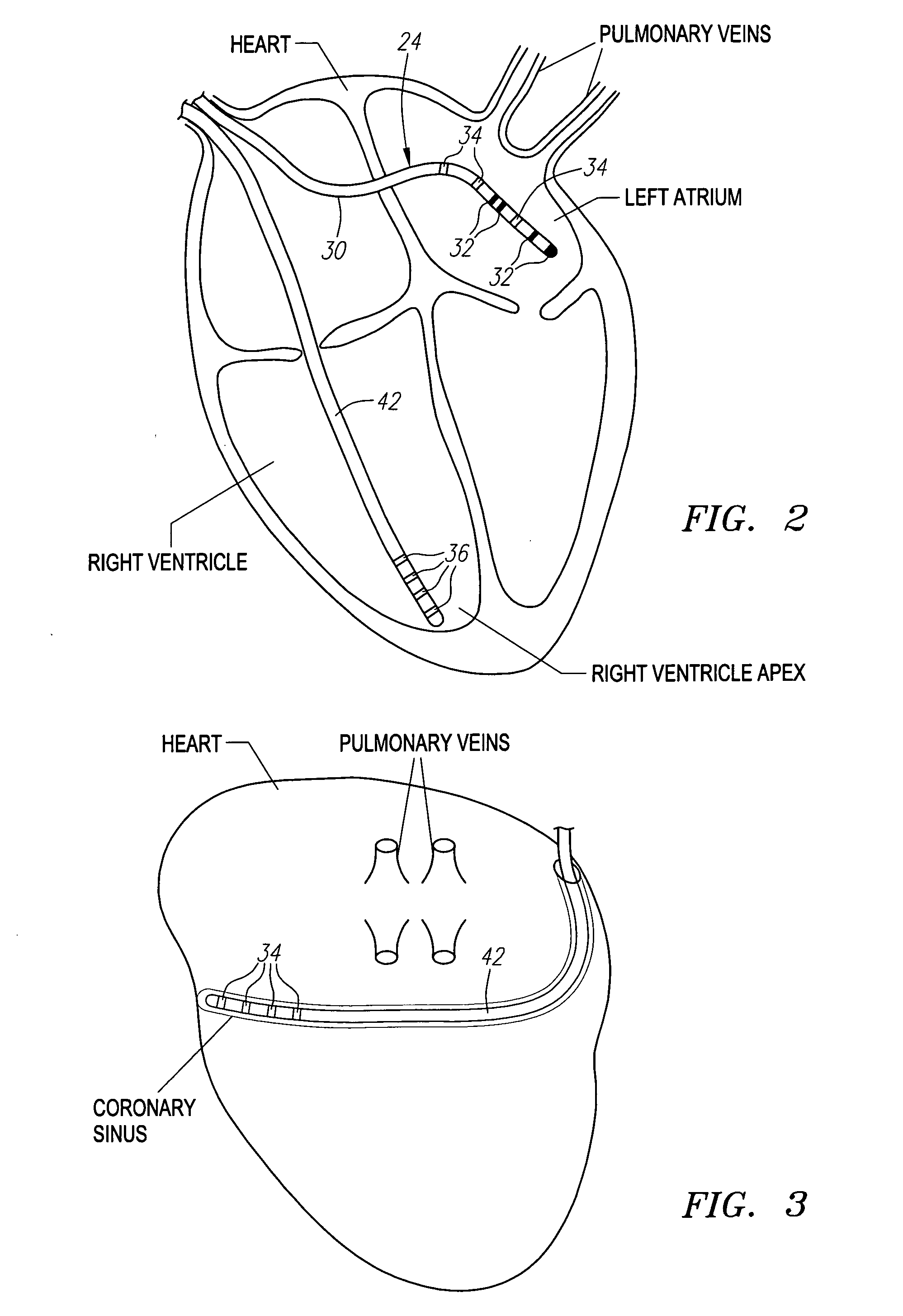 Method and system for registering an image with a navigation reference catheter
