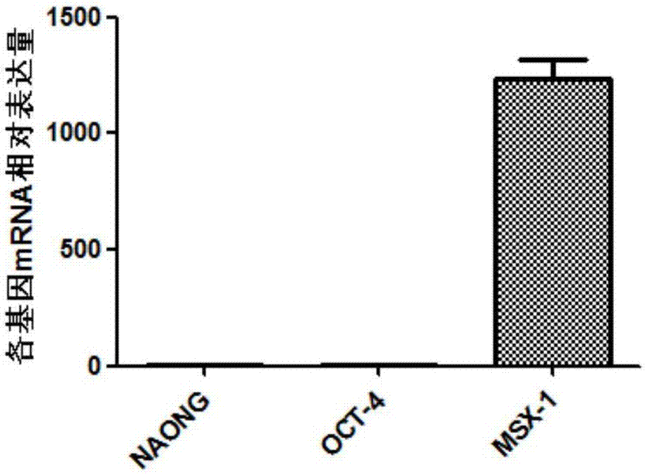 Culture medium and application thereof and method for preparing mesenchyme stem cells through urine cells