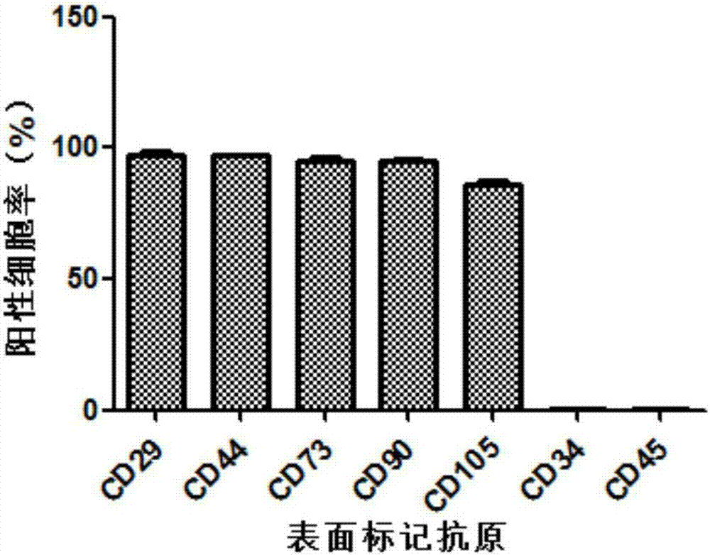 Culture medium and application thereof and method for preparing mesenchyme stem cells through urine cells