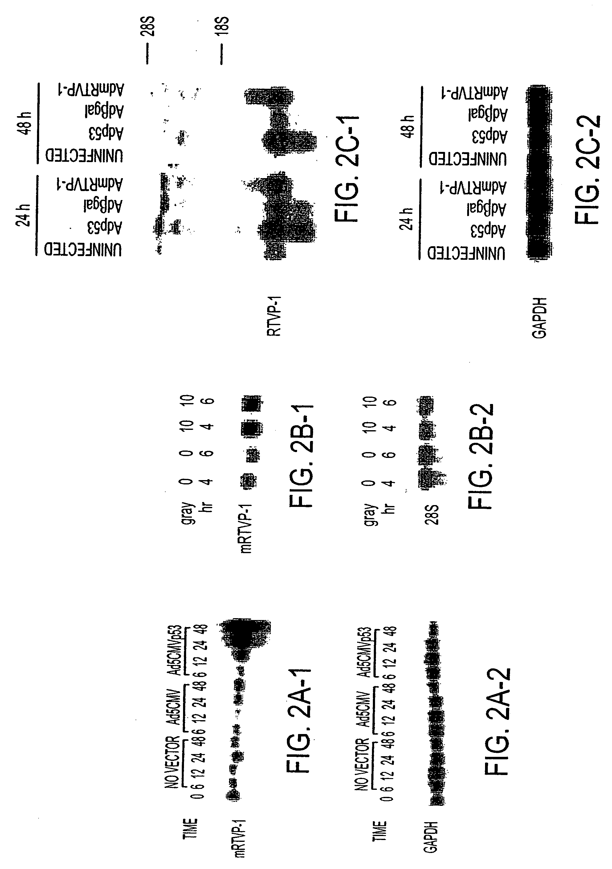 RTVP based compositions and methods for the treatment of prostate cancer