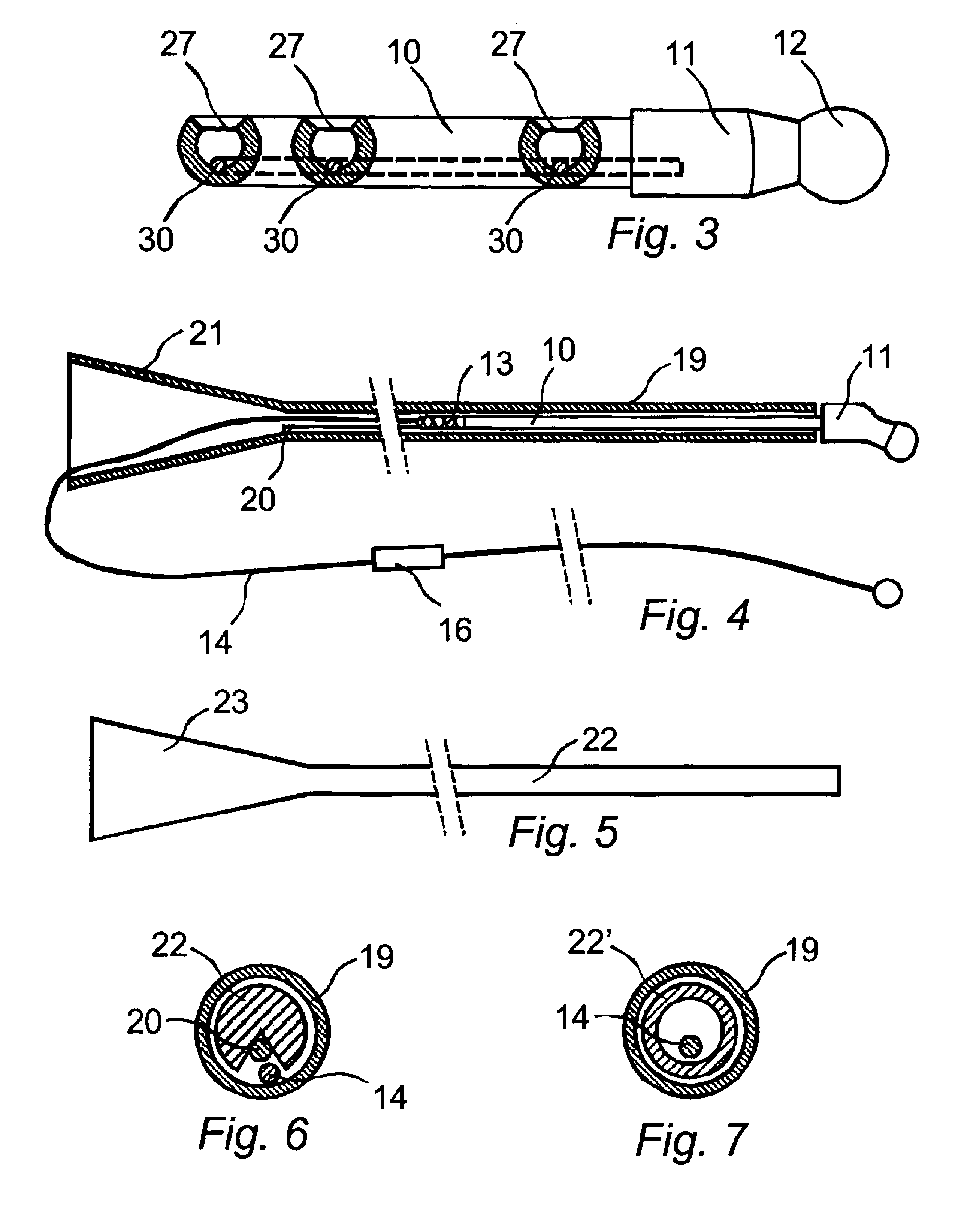 Method and apparatus for insertion of self-draining urine apparatus into bladder