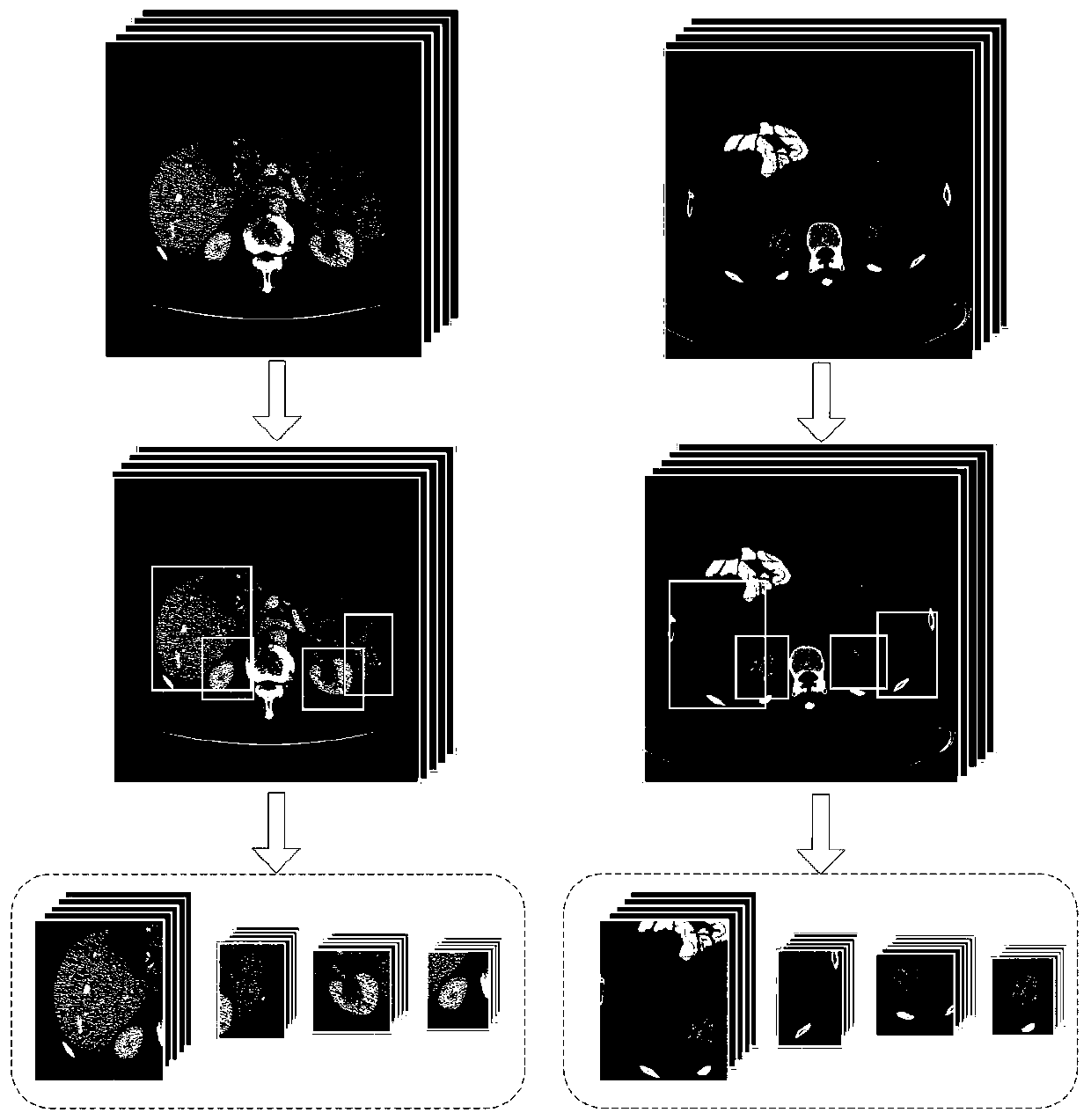 Abdominal CT image target organ registration method based on deep learning