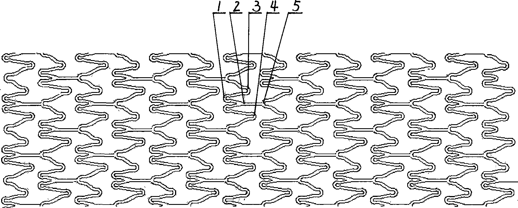 Double top-cover coronary bracket