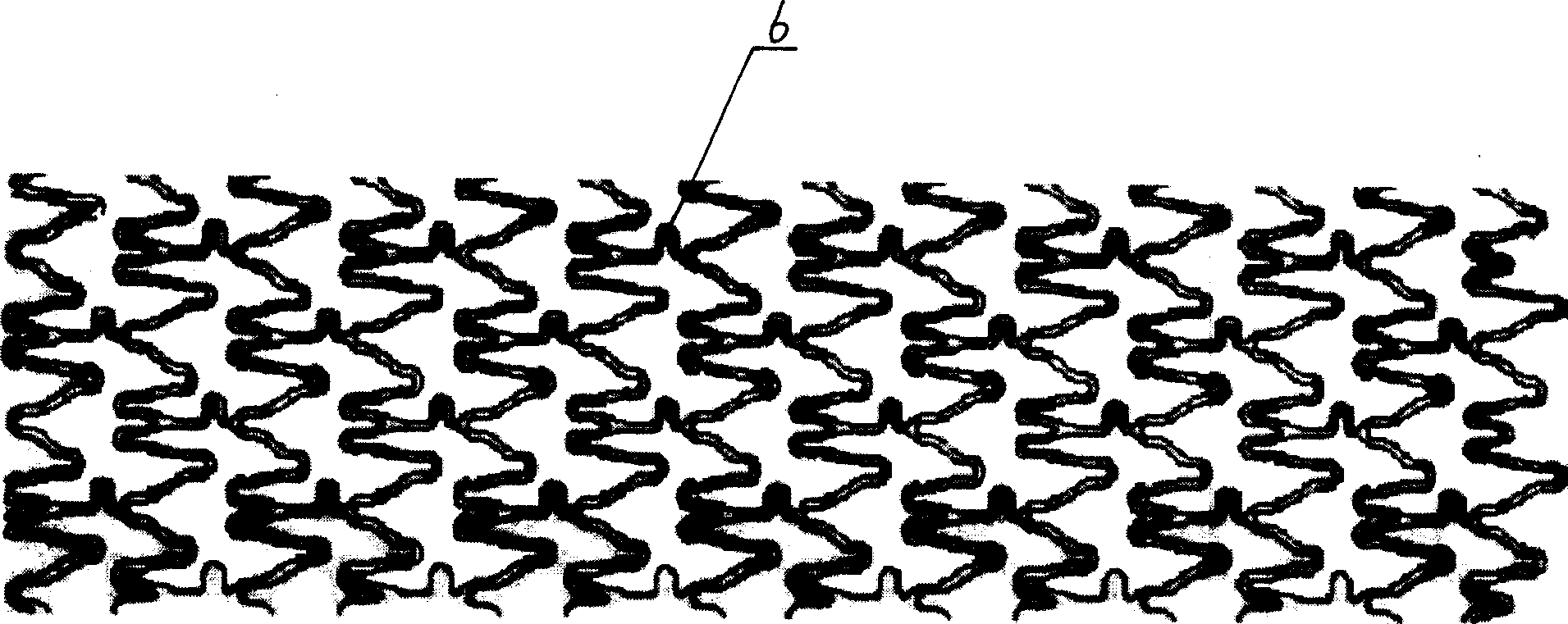 Double top-cover coronary bracket