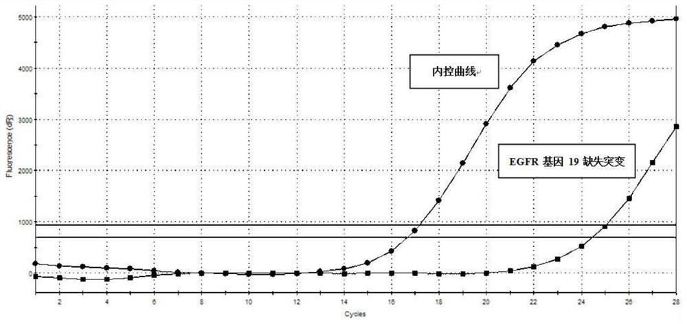 Extraction method of cfdna in sputum specimen