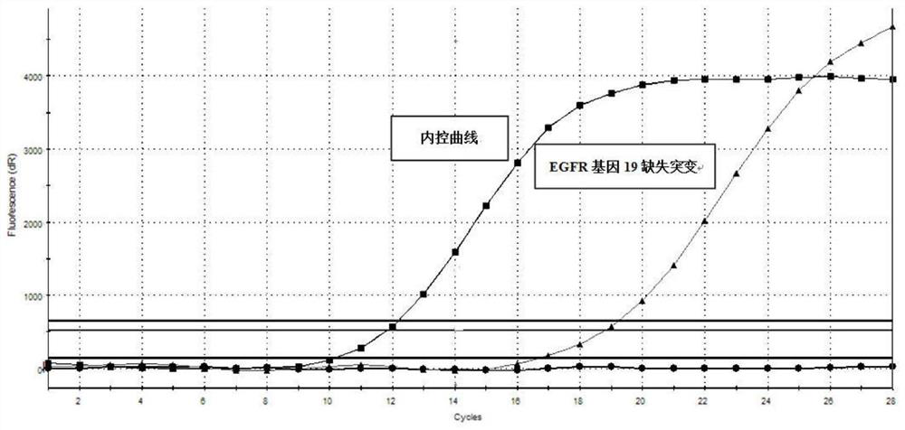 Extraction method of cfdna in sputum specimen