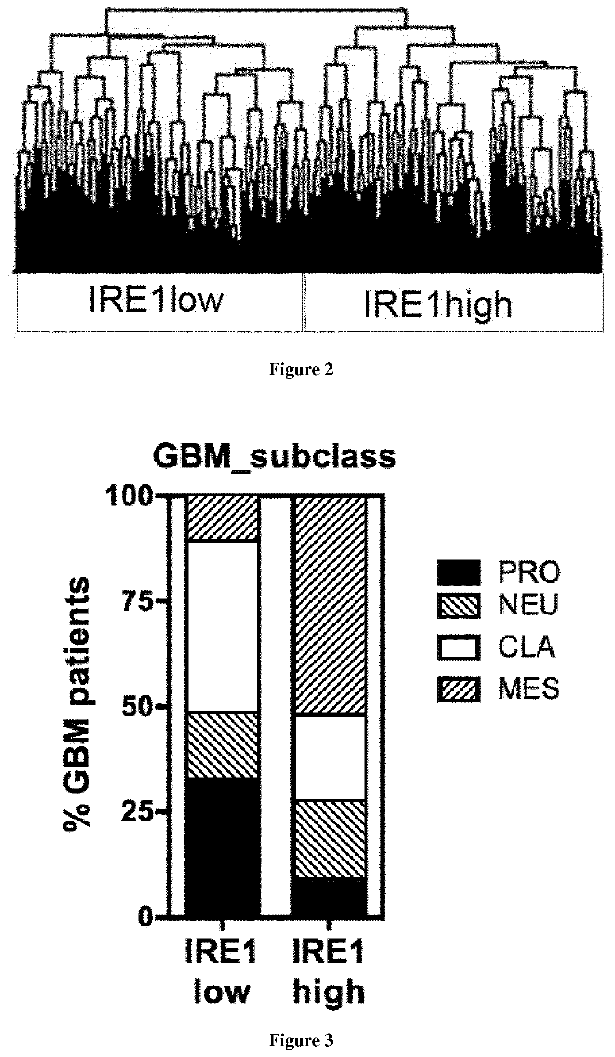 Method of selection of an ire1-inhibitor therapy for patient suffering from cancer