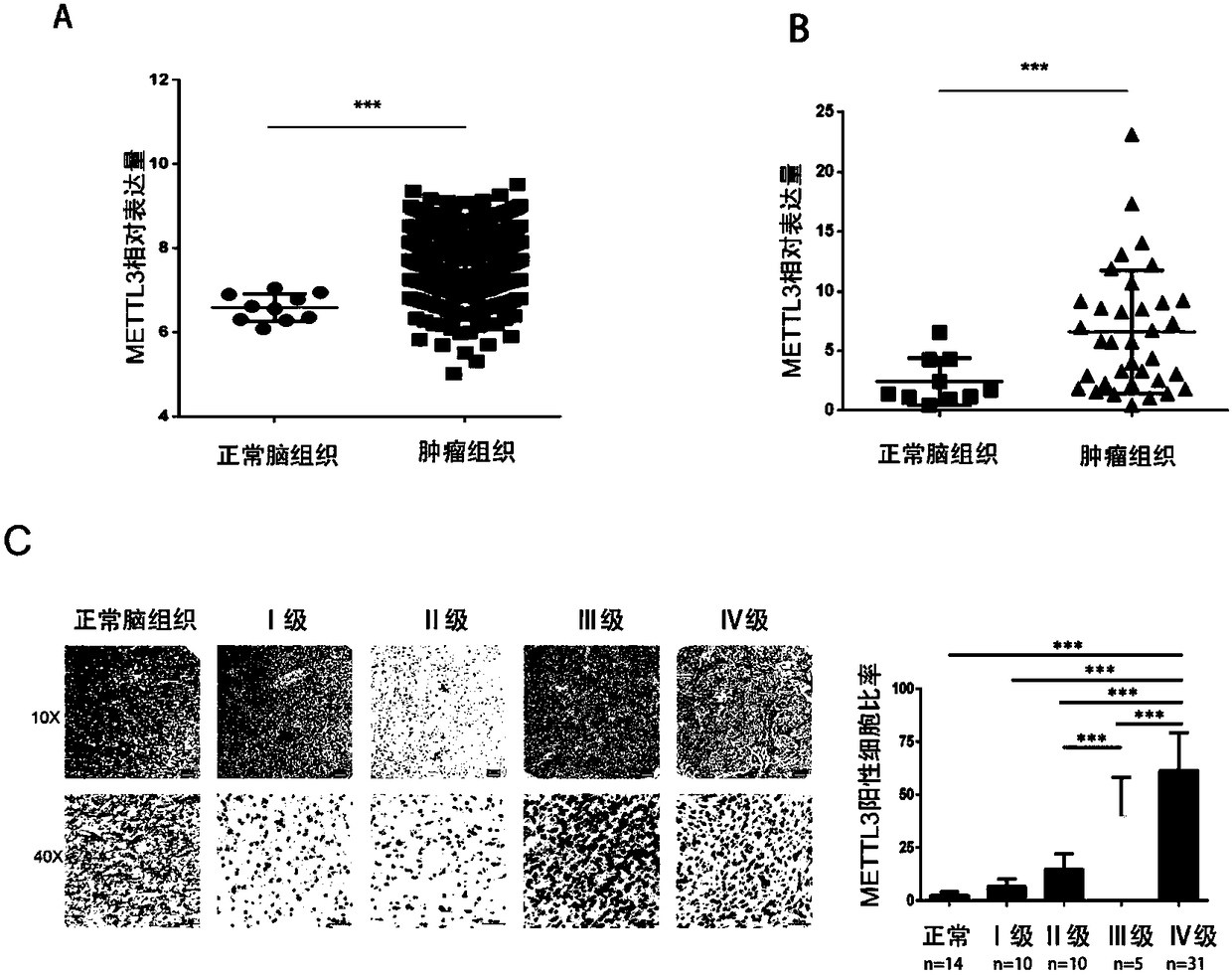 Marker for glioblastoma, application thereof and kit