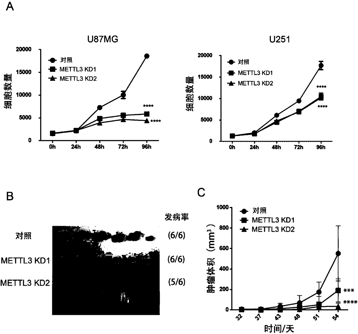 Marker for glioblastoma, application thereof and kit