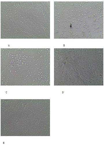 4-amino-acid-substituted pyrimidine nucleoside compound and medicinal application thereof