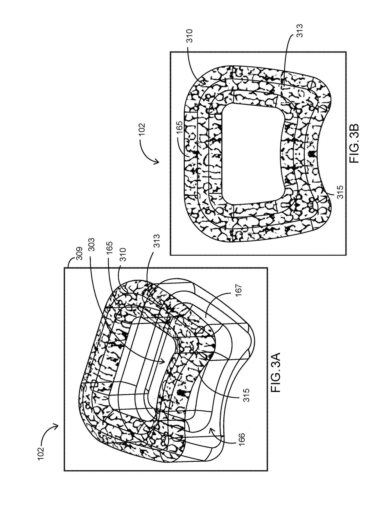 Systems and methods for the patterning of material substrates