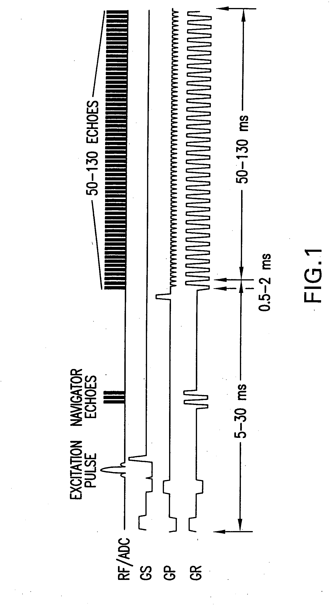 Low-impact noise acquisition magnetic resonance imaging