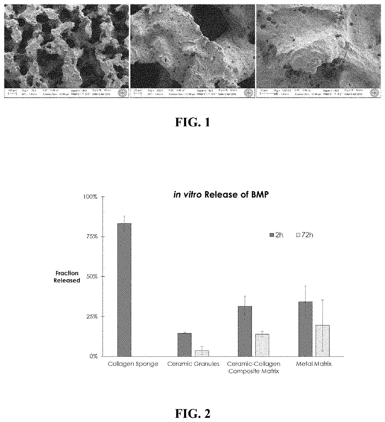 Protein delivery with porous metallic structure