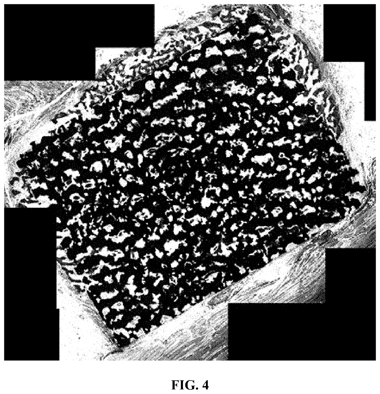 Protein delivery with porous metallic structure