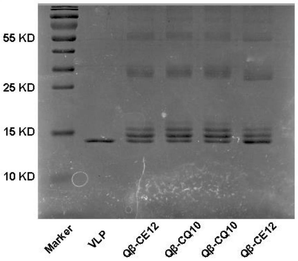 Chimeric bivalent antihypertensive vaccine targeting human vascular smooth muscle cell L-type calcium channel and angiotensin-1 receptor and its application