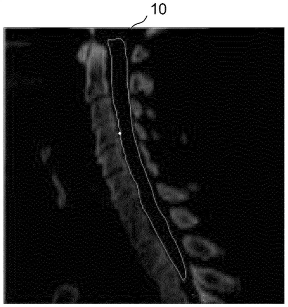 Dose guided deformable image registration