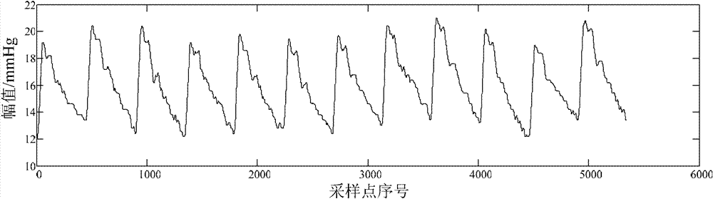 Method for recognizing intracranial pressure signal characteristic peaks