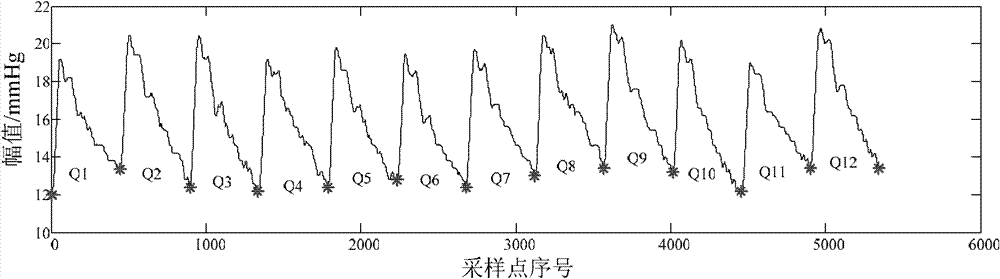 Method for recognizing intracranial pressure signal characteristic peaks