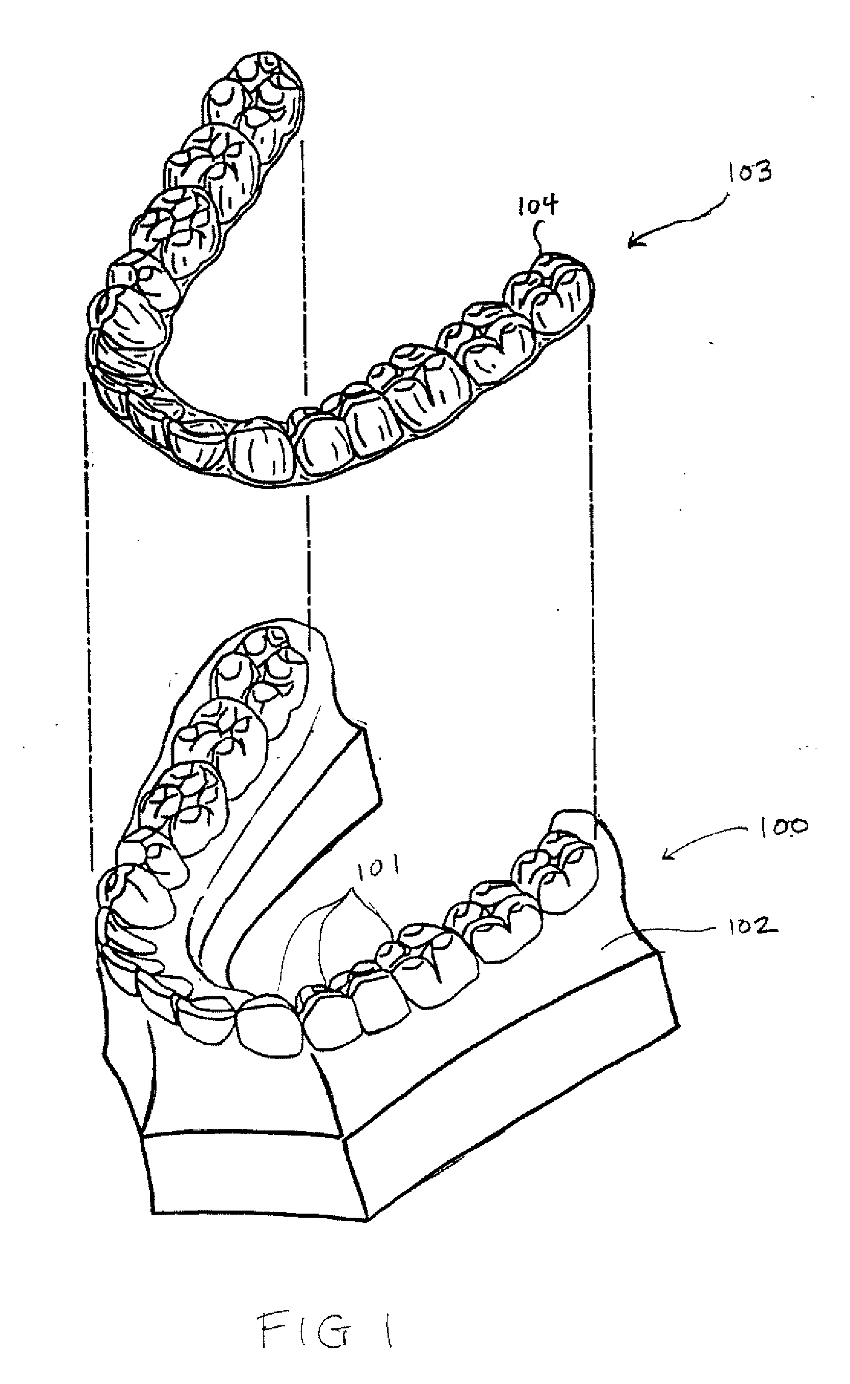Reconfigurable dental model system for fabrication of dental appliances