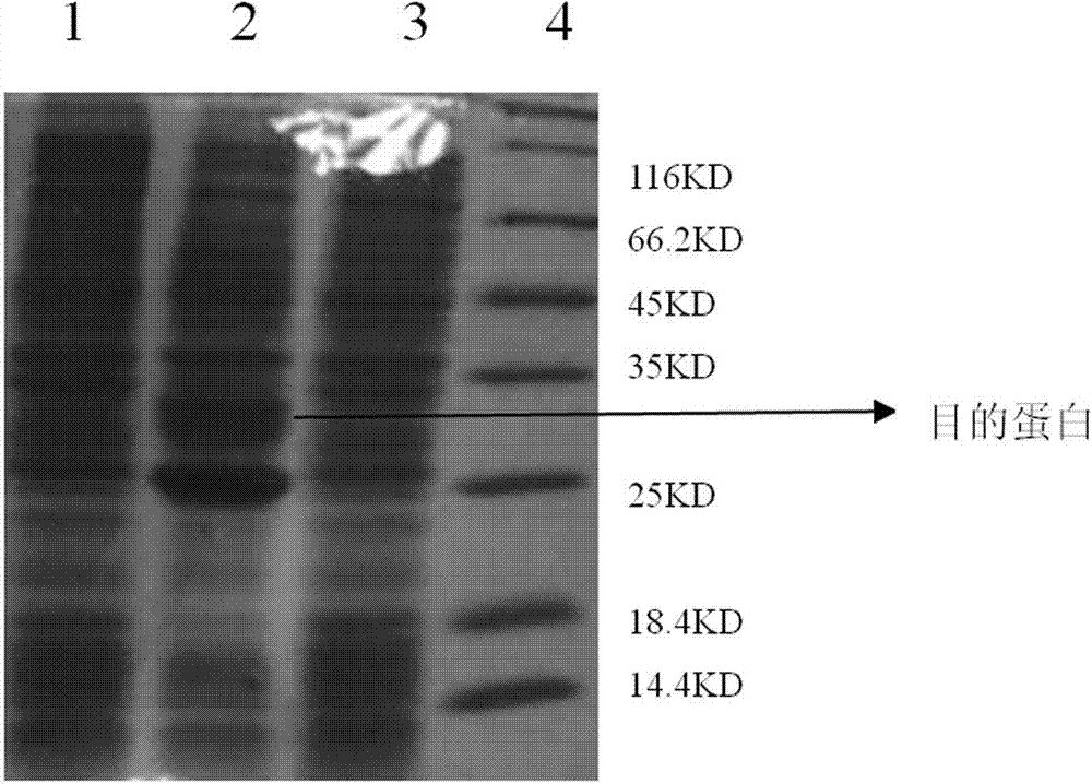 Preparation and application methods of genetically engineered bacterium expressing thymosin beta4