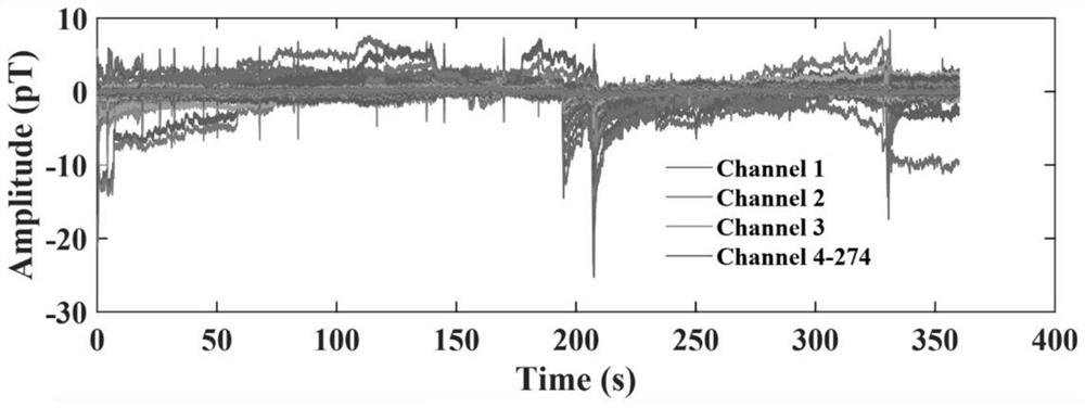 Neural network-based magnetoencephalogram eye movement artifact detection and elimination method and electronic device