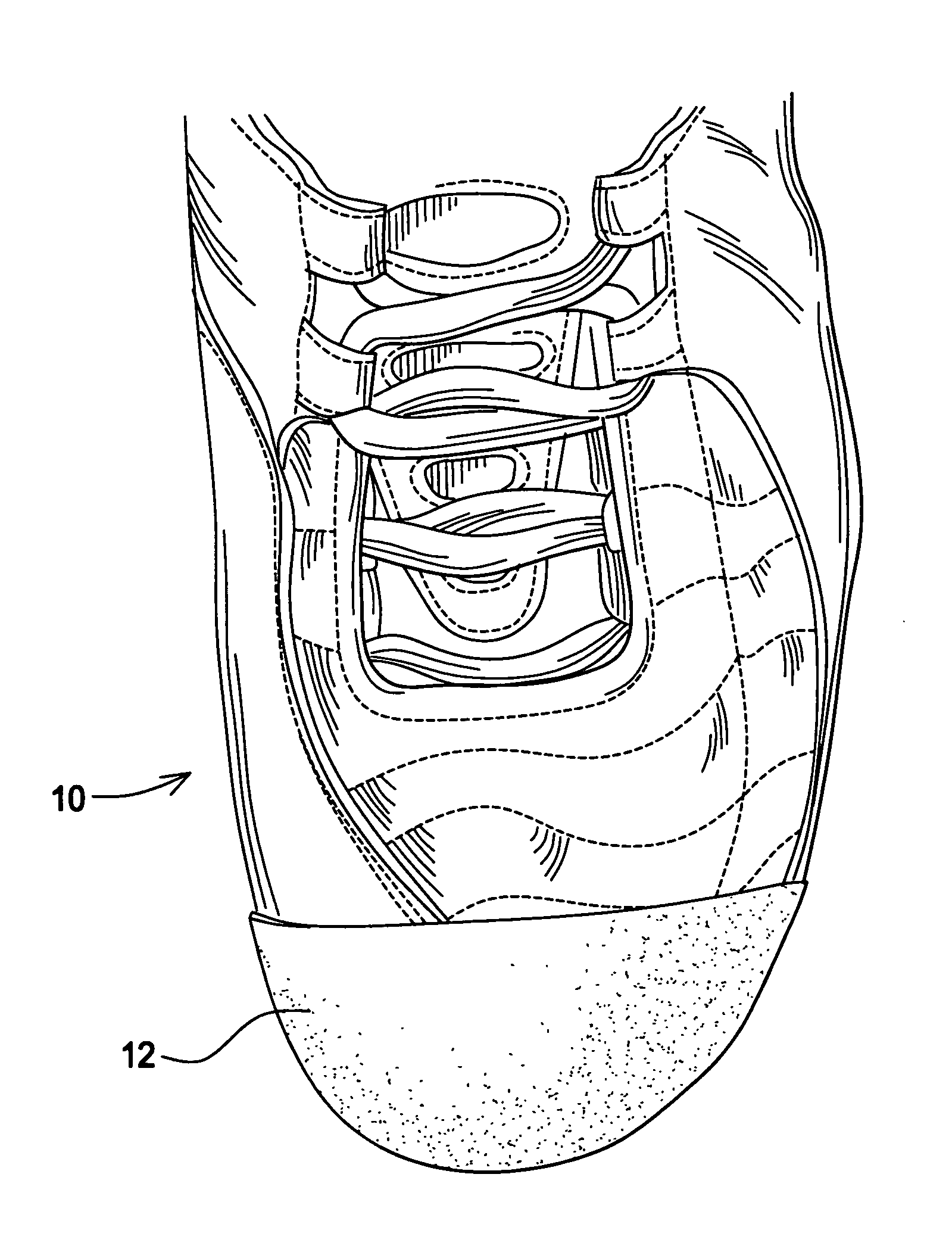 Spray-formed reinforcement for footwear