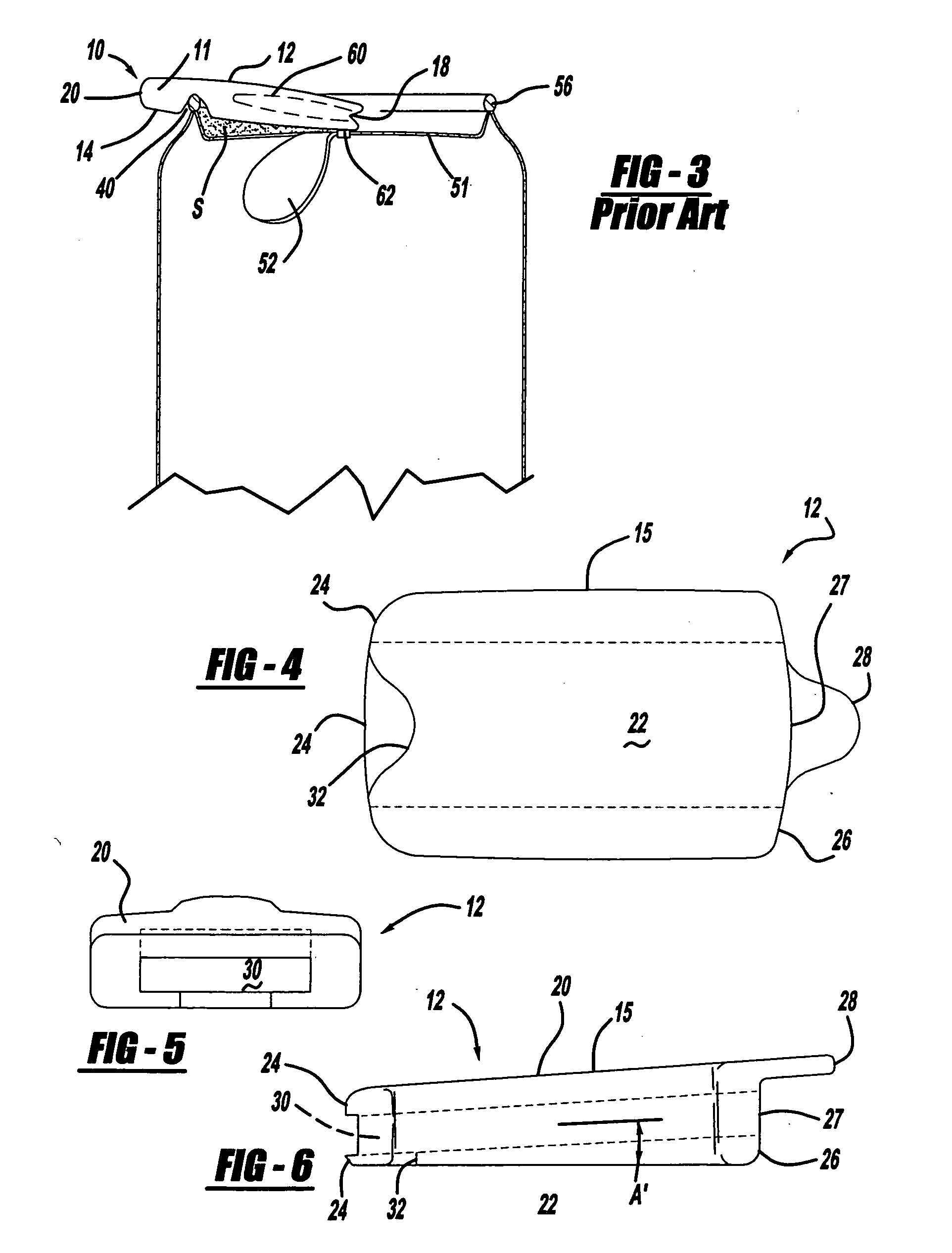 Ring-tab extending sleeve for easy opening and re-closing the opening of a beverage container