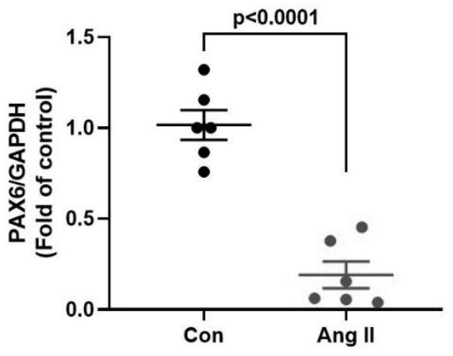 Application of pax6 gene or its expression product in preparation of medicine for inhibiting fibrosis