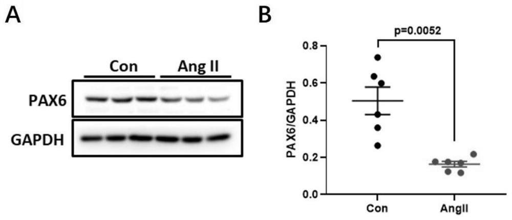 Application of pax6 gene or its expression product in preparation of medicine for inhibiting fibrosis