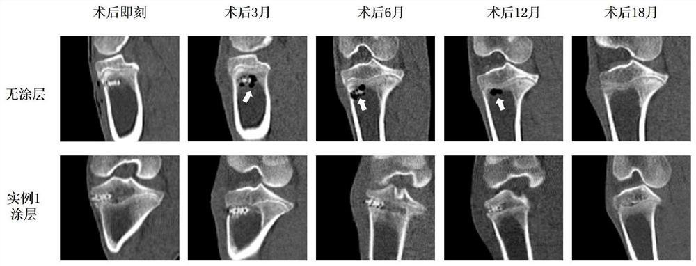 Surface coating capable of degrading magnesium and magnesium alloy and preparation method of surface coating