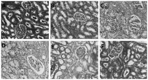 A traditional Chinese medicine composition for assisting in improving renal function in patients with chronic kidney disease