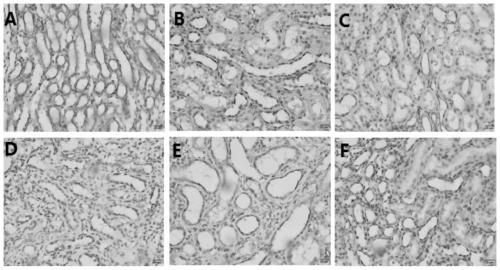 A traditional Chinese medicine composition for assisting in improving renal function in patients with chronic kidney disease