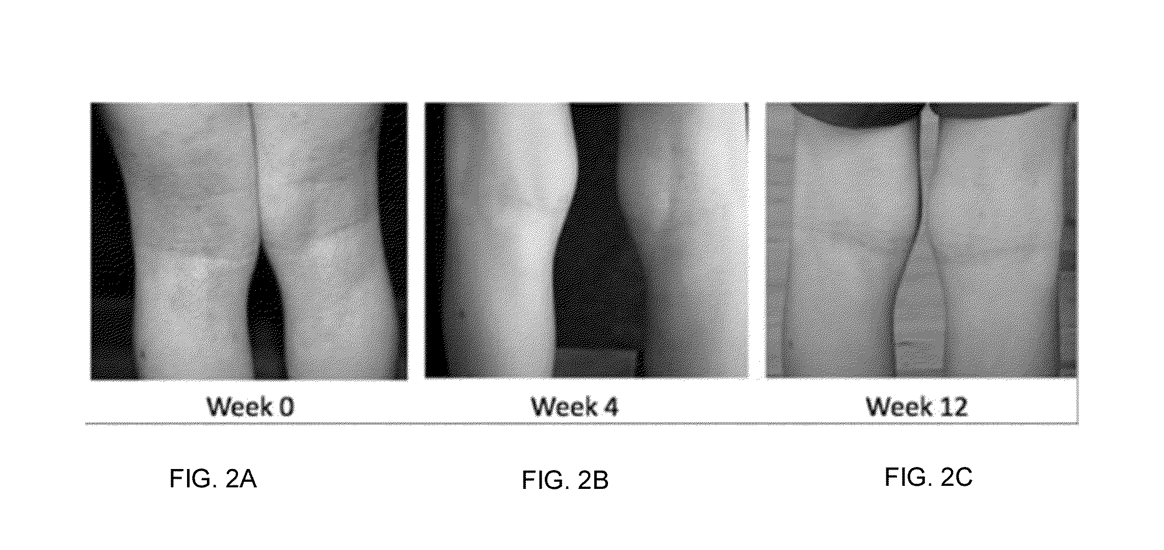 Dietary supplement composition as a prophylactic and treatment for skin diseases such as eczema and psoriasis and the like and method of treatment