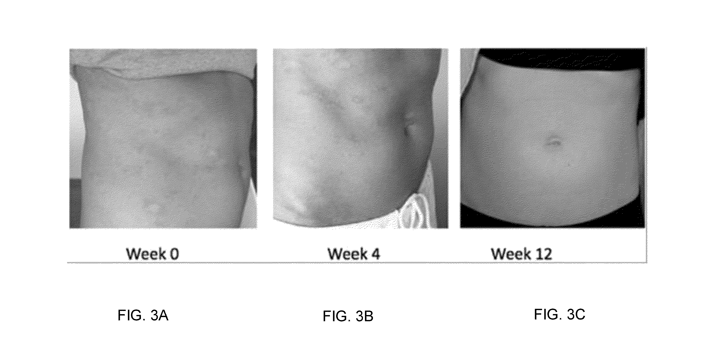 Dietary supplement composition as a prophylactic and treatment for skin diseases such as eczema and psoriasis and the like and method of treatment