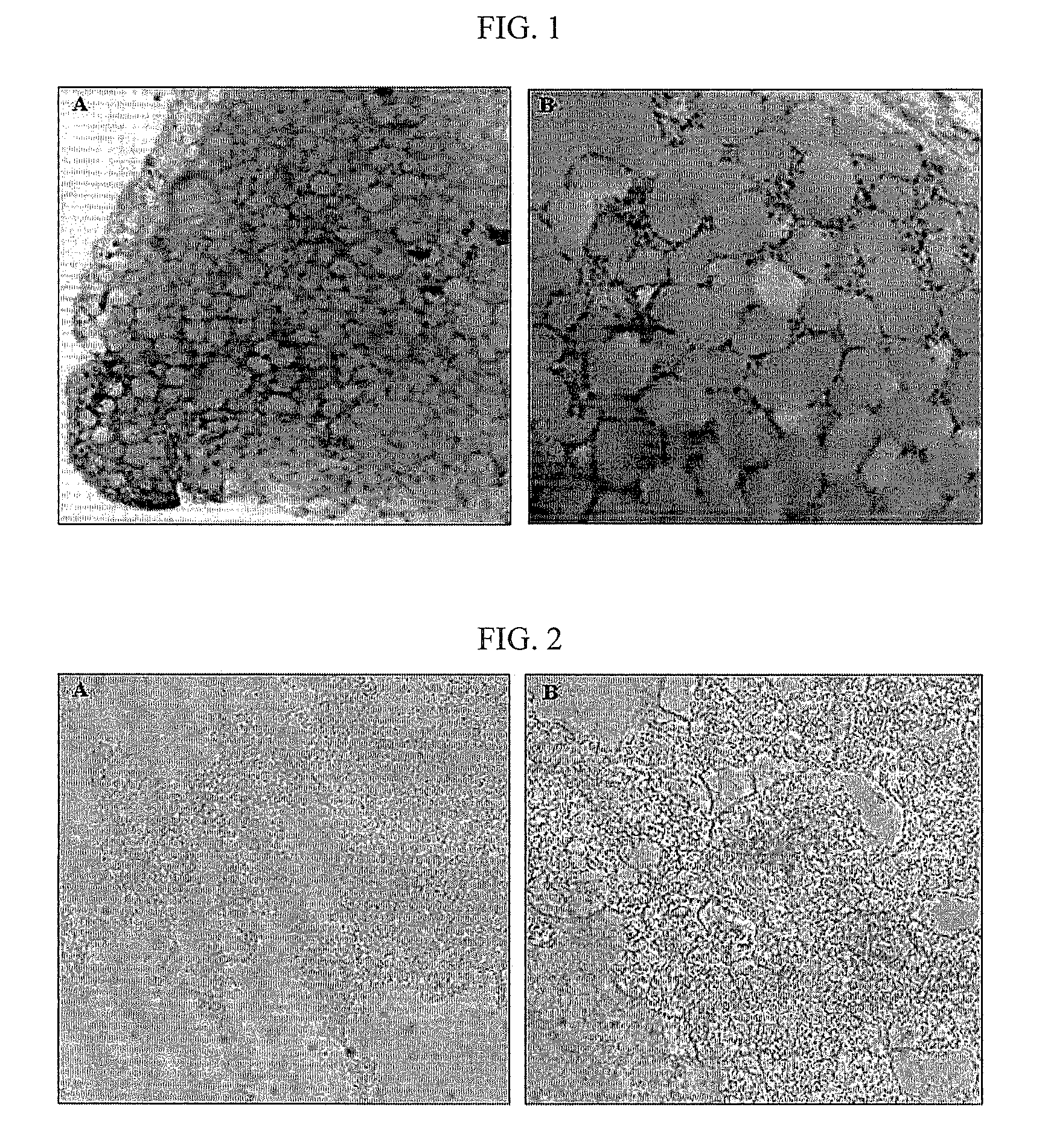 Lipid-free scaffolds for human volume replacement or cell culture and use thereof