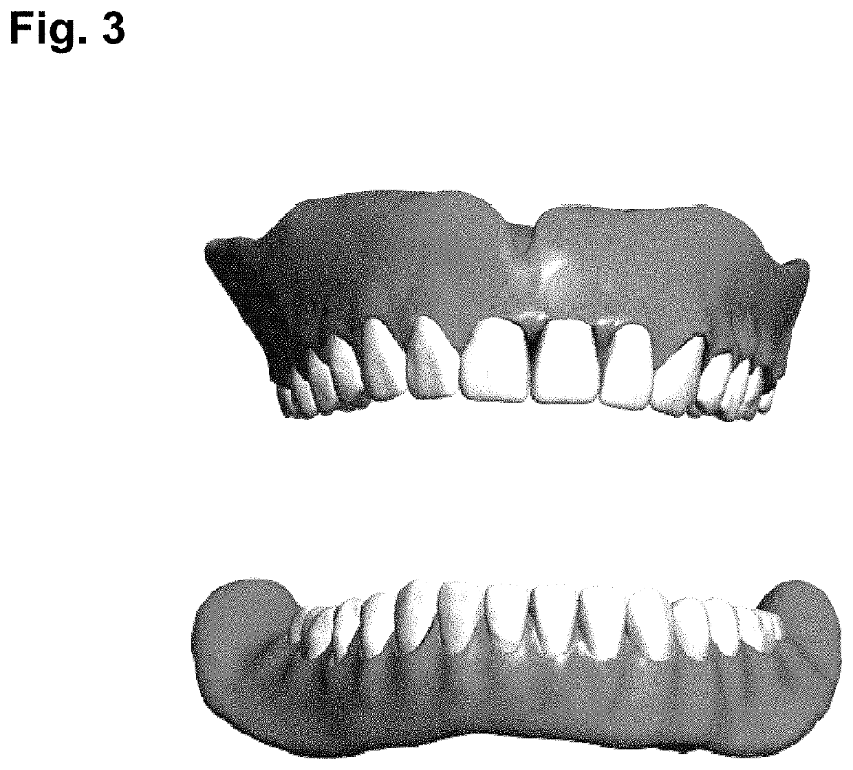 Photo-curable resin compositions and method of using the same in three-dimensional printing for manufacturing artificial teeth and denture base